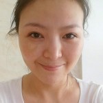 眼袋没有了,谢谢超声波去眼袋673 眼袋没有了,谢谢超声波去眼袋673
