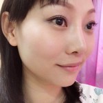 超声波去眼袋!自信满棚!148 超声波去眼袋!自信满棚!148