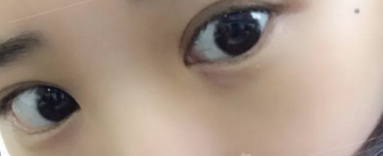 年轻人就该用超声波去眼袋把眼袋去掉668 年轻人就该用超声波去眼袋把眼袋去掉668