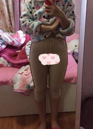 超声波减肥瘦大腿，看看这改变我大象腿的技术吧853