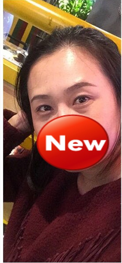 超声波去眼袋,轻轻松松去眼袋939 超声波去眼袋,轻轻松松去眼袋939