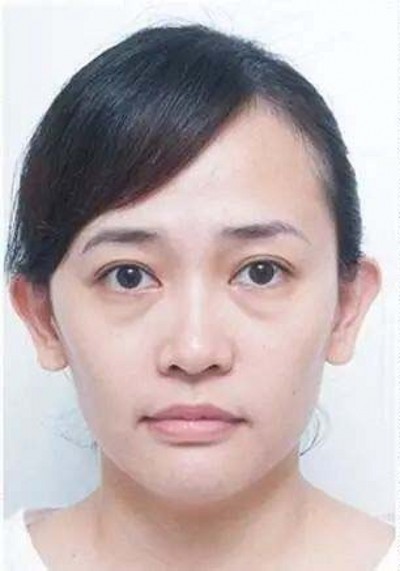 选择超声波去眼袋,没错921 选择超声波去眼袋,没错921