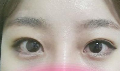 超 声 波去眼袋让wǒwǒ用“眼”技征服客户! 超 声 波去眼袋让wǒwǒ用“眼”技征服客户!
