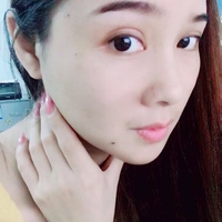 做了彭氏童颜术,就算30岁也不害怕481 做了彭氏童颜术,就算30岁也不害怕481
