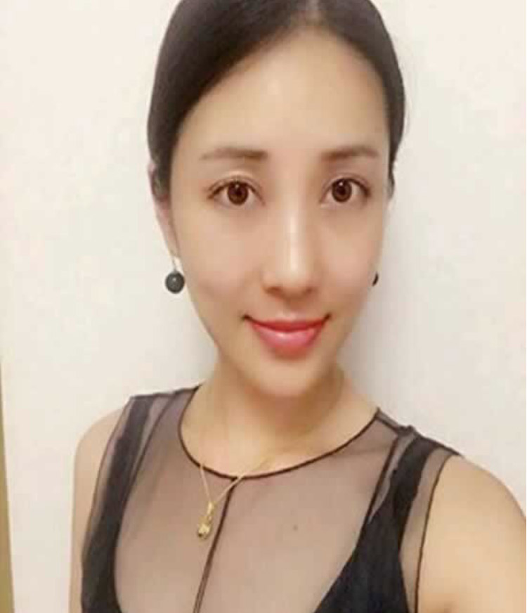 去眼袋好轻松就是因为超声波去眼袋094 去眼袋好轻松就是因为超声波去眼袋094