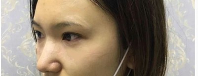眼袋去不le,试试这种办法 眼袋去不le,试试这种办法