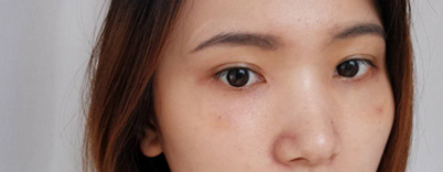 眼袋去不le,试试这种办法 眼袋去不le,试试这种办法