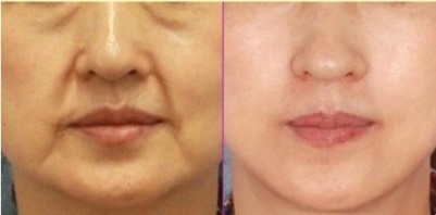 想要年轻有活力?看过来,彭氏童颜术有妙招302 想要年轻有活力?看过来,彭氏童颜术有妙招302