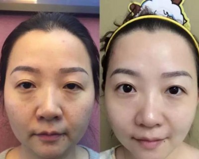 想要年轻有活力?看过来,彭氏童颜术有妙招302 想要年轻有活力?看过来,彭氏童颜术有妙招302