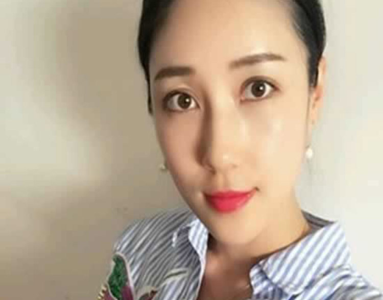 急救科得医生做le超 声 波去眼袋以后再也不长眼袋le