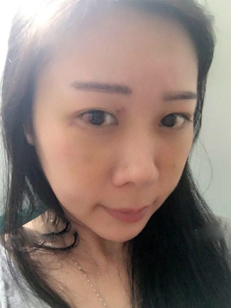 做了一次超声波祛眼袋后看手机再也不长眼袋599 做了一次超声波祛眼袋后看手机再也不长眼袋599