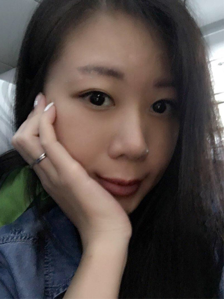 做了一次超声波祛眼袋后看手机再也不长眼袋599 做了一次超声波祛眼袋后看手机再也不长眼袋599