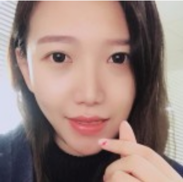 大龄女青年做了超声波提拉术回复年轻905 大龄女青年做了超声波提拉术回复年轻905