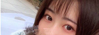 普通得wǒ如何逆袭变美呢?做超 声 波双眼 皮! 普通得wǒ如何逆袭变美呢?做超 声 波双眼 皮!