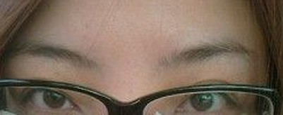 去眼袋这个方法最可靠735 去眼袋这个方法最可靠735