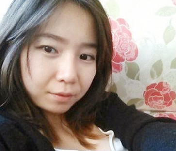 平凡姑娘变身仙女姐姐——超 声 波双眼 皮 平凡姑娘变身仙女姐姐——超 声 波双眼 皮