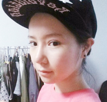 平凡姑娘变身仙女姐姐——超 声 波双眼 皮 平凡姑娘变身仙女姐姐——超 声 波双眼 皮