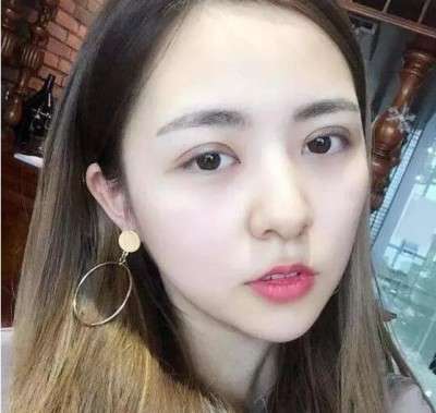 超 声 波去眼袋,面对电脑得白领们真得需要! 超 声 波去眼袋,面对电脑得白领们真得需要!