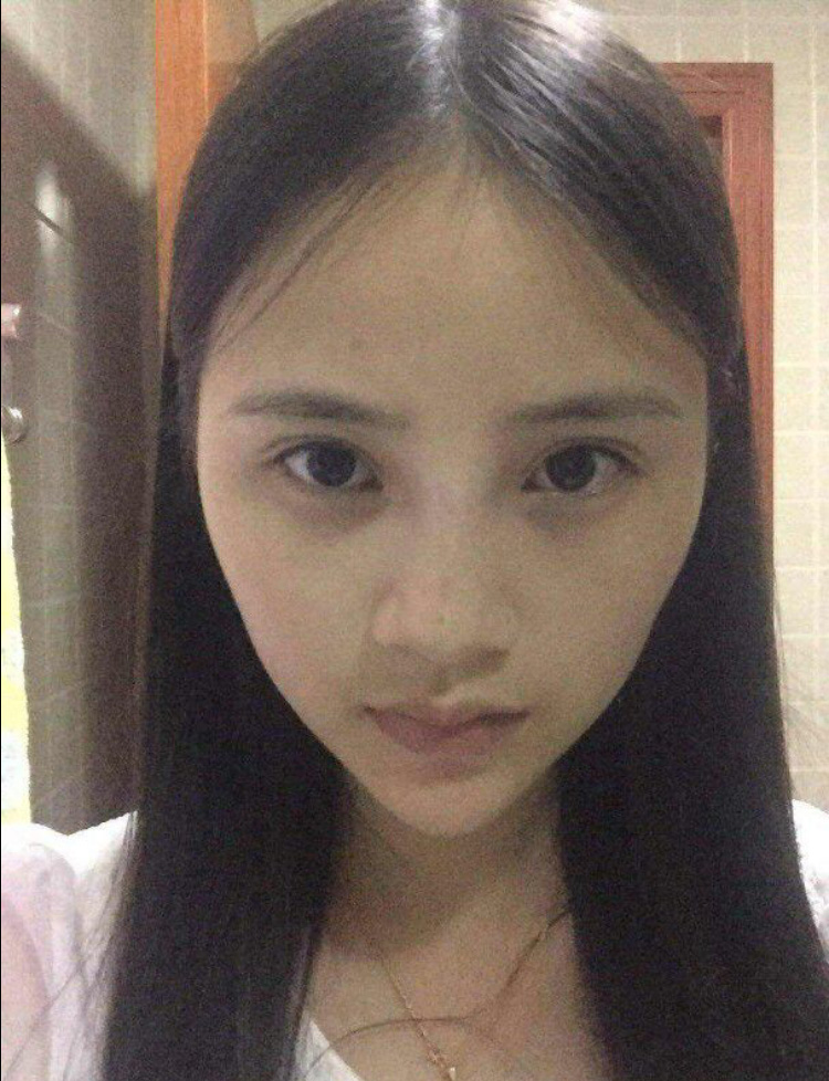 做超声波双眼皮以后我和男友的感情变好049 做超声波双眼皮以后我和男友的感情变好049