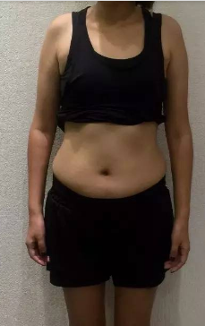 超声波减肥让我变身小仙女430 超声波减肥让我变身小仙女430