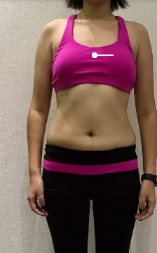 超声波减肥让我变身小仙女430 超声波减肥让我变身小仙女430