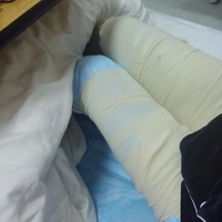 超声波减肥,美腿秘籍055 超声波减肥,美腿秘籍055