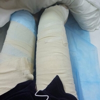 超声波减肥,美腿秘籍055 超声波减肥,美腿秘籍055