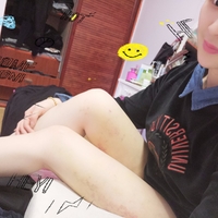 超声波减肥,美腿秘籍055 超声波减肥,美腿秘籍055