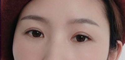超 声 波去眼袋让衰老再不shì无可奈何! 超 声 波去眼袋让衰老再不shì无可奈何!