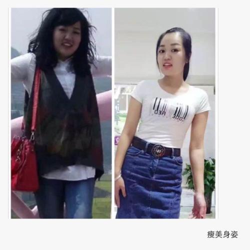 关于减肥手术的问题205 关于减肥手术的问题205