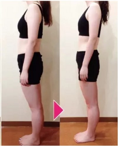 超声波减肥法,带给我无穷的惊喜462 超声波减肥法,带给我无穷的惊喜462
