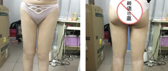 超声波减肥瘦大腿前后差距太大，简直辣眼睛啦~552