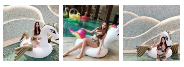 经过多番考虑以后wǒ就到超雅做le靠谱得自体脂肪丰胸