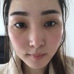 我很看好超声波去眼袋083 我很看好超声波去眼袋083