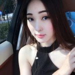 我很看好超声波去眼袋083 我很看好超声波去眼袋083