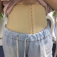 超声波减肥照相更有魅力626 超声波减肥照相更有魅力626