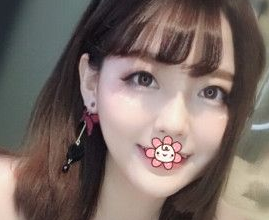 做双眼 皮还shì用超 声 波双眼 皮，效果真心好！