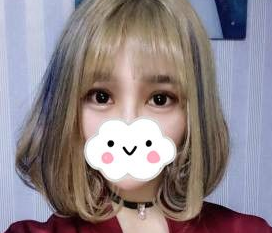 想了解超声波双眼皮?看我的恢复日记916 想了解超声波双眼皮?看我的恢复日记916