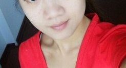 超声波瘦脸恢复真的挺快的,来看效果!326 超声波瘦脸恢复真的挺快的,来看效果!326