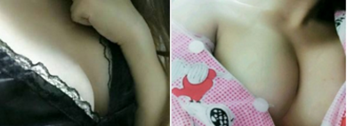 亲身感受超 声 波自体脂肪丰胸效果 亲身感受超 声 波自体脂肪丰胸效果