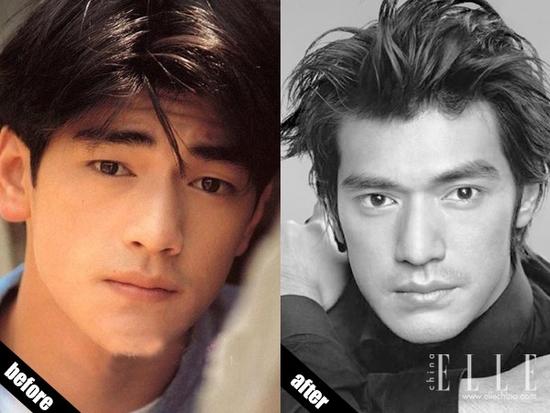 小眼男能做超声波双眼皮手术吗?846 小眼男能做超声波双眼皮手术吗?846