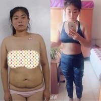 超声波减肥,和肚子脂肪说拜拜938 超声波减肥,和肚子脂肪说拜拜938