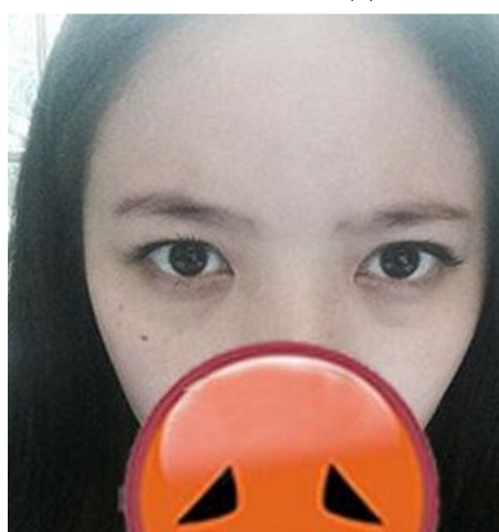 分享我是如何去掉眼袋的888 分享我是如何去掉眼袋的888
