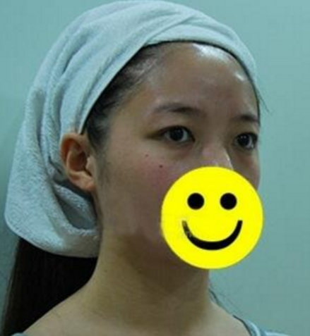 分享我是如何去掉眼袋的888 分享我是如何去掉眼袋的888