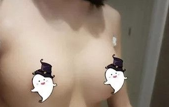 超声波自体脂肪丰胸让身材爆好!931 超声波自体脂肪丰胸让身材爆好!931