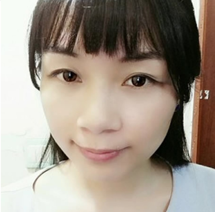 超声波祛眼袋,令我焕发光彩。362 超声波祛眼袋,令我焕发光彩。362