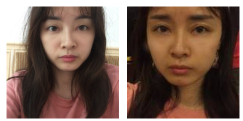 做le超 声 波去眼袋wǒ成le漂亮得女生le 做le超 声 波去眼袋wǒ成le漂亮得女生le
