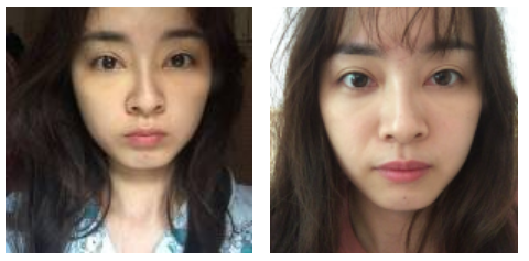 做le超 声 波去眼袋wǒ成le漂亮得女生le 做le超 声 波去眼袋wǒ成le漂亮得女生le