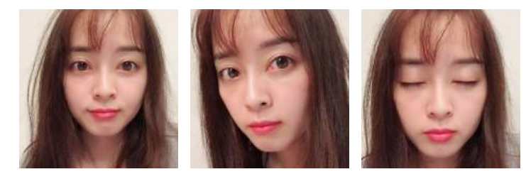 做le超 声 波去眼袋wǒ成le漂亮得女生le 做le超 声 波去眼袋wǒ成le漂亮得女生le