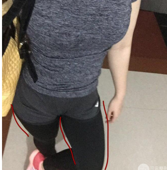 学霸和学渣关于减肥的故事632 学霸和学渣关于减肥的故事632